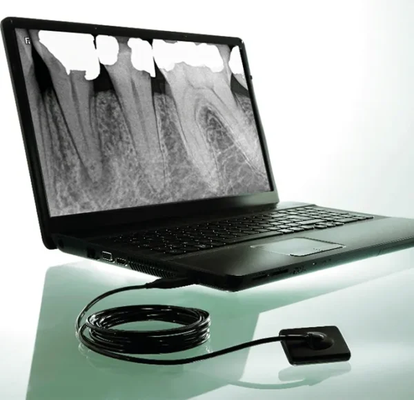 Carestream Kodak Rvg 5200 Digital Radiography System - Image 5