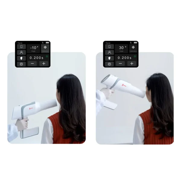 Woodpecker Ai Ray Portable X-Ray Machine - Image 5