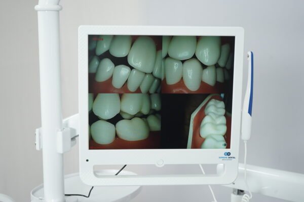 Supreme Intraoral Camera